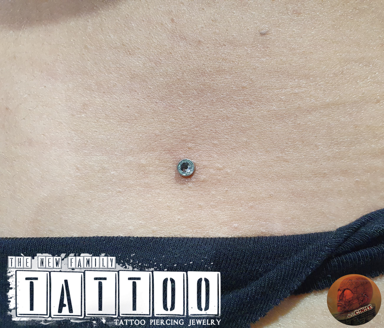 dermal345t