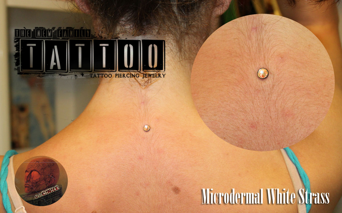 microdermal454t