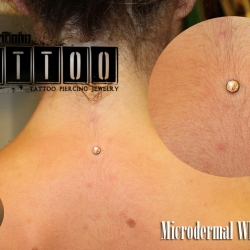 microdermal454t